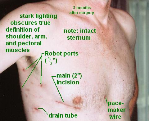 the only visible evidence of surgery